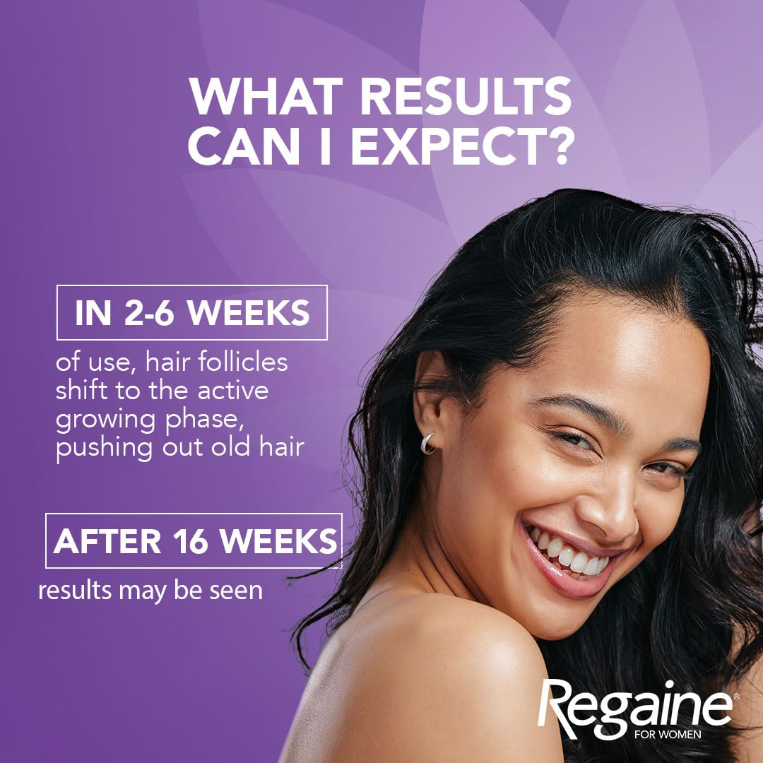 Regaine/Rogaine for Women Regular Strength Scalp Solution (1x 60ml bottle), Hair Regrowth Treatment for Hereditary Hair Loss, Female Hair Loss Solution with 2% Minoxidil