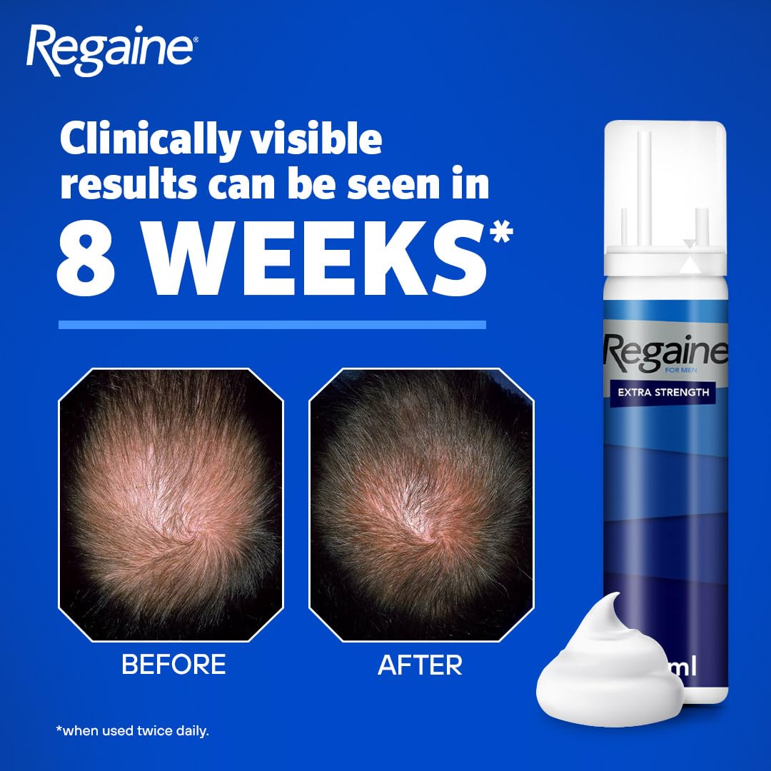 Regaine/Rogaine For Men Hair Regrowth Foam 3 x 73ml (Packing May Vary)